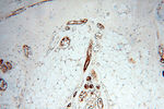 STRAP Antibody in Immunohistochemistry (Paraffin) (IHC (P))