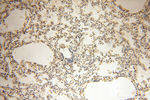 STRAP Antibody in Immunohistochemistry (Paraffin) (IHC (P))