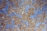 STRAP Antibody in Immunohistochemistry (Paraffin) (IHC (P))