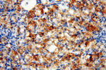 STRAP Antibody in Immunohistochemistry (Paraffin) (IHC (P))