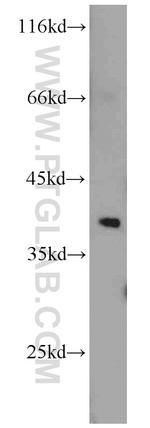 STRAP Antibody in Western Blot (WB)
