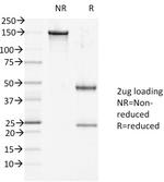 Desmoglein-1 (DSG1) Monoclonal Antibody (27B2)