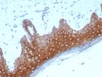 Desmoglein-1 (DSG1) Recombinant Rabbit Monoclonal Antibody (DSG1/8576R)
