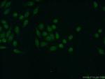 TDP-43 Antibody in Immunocytochemistry (ICC/IF)