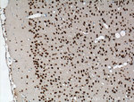 TDP-43 Antibody in Immunohistochemistry (Paraffin) (IHC (P))