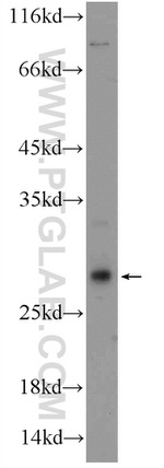CCDC85B Antibody in Western Blot (WB)