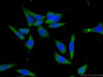 CCDC85B Antibody in Immunocytochemistry (ICC/IF)