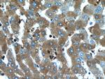 CCDC85B Antibody in Immunohistochemistry (Paraffin) (IHC (P))