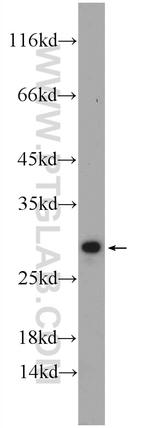 CCDC85B Antibody in Western Blot (WB)