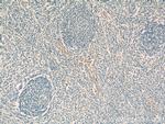 CD93 Antibody in Immunohistochemistry (Paraffin) (IHC (P))