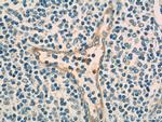 CD93 Antibody in Immunohistochemistry (Paraffin) (IHC (P))