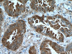 HSP27 Antibody in Immunohistochemistry (Paraffin) (IHC (P))