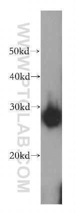HSP27 Antibody in Western Blot (WB)