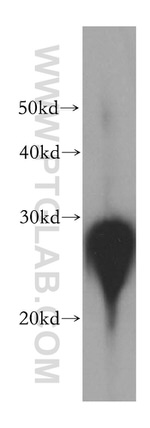 HSP27 Antibody in Western Blot (WB)