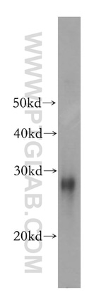 HSP27 Antibody in Western Blot (WB)