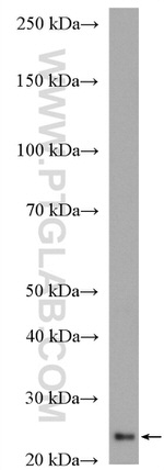 HSP27 Antibody in Western Blot (WB)