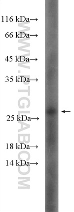 HSP27 Antibody in Western Blot (WB)