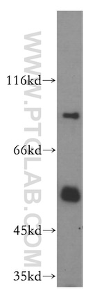 DDX19B Antibody in Western Blot (WB)