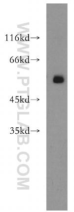 DDX19B Antibody in Western Blot (WB)
