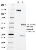 TAG-72/CA72.4 (Tumor-Associated Glycoprotein) Antibody in SDS-PAGE (SDS-PAGE)