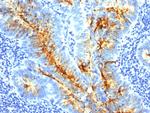 TAG-72/CA72.4 (Tumor-Associated Glycoprotein) Monoclonal Antibody (SPM536)