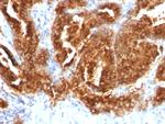 TAG-72/CA72.4 (Tumor-Associated Glycoprotein) Monoclonal Antibody (CA72, 733)