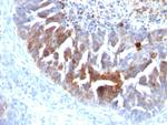 TAG-72/CA72.4 (Tumor-Associated Glycoprotein) Antibody in Immunohistochemistry (Paraffin) (IHC (P))