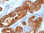 TAG-72/CA72.4 (Tumor-Associated Glycoprotein) Monoclonal Antibody (B72.3, CC49)