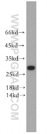 KCNE4 Antibody in Western Blot (WB)