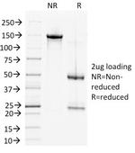 Desmoglein-2 (DSG2) Monoclonal Antibody (6D8)