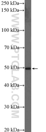MEF2C Antibody in Western Blot (WB)