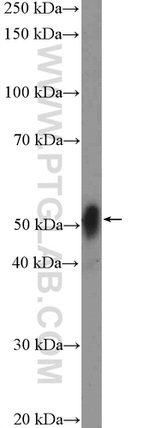 MEF2C Antibody in Western Blot (WB)