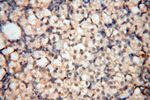 MEF2C Antibody in Immunohistochemistry (Paraffin) (IHC (P))