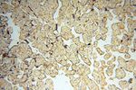 MEF2C Antibody in Immunohistochemistry (Paraffin) (IHC (P))