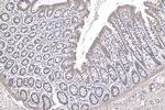 NRAS Antibody in Immunohistochemistry (Paraffin) (IHC (P))