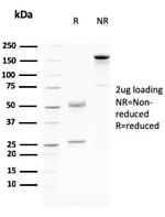 Desmoglein-3 Antibody in SDS-PAGE (SDS-PAGE)