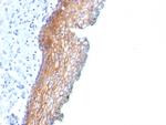 Desmoglein-3 Monoclonal Antibody (DSG3, 2838)