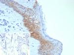 Desmoglein-3 (Squamous Cell Marker) Recombinant Rabbit Monoclonal Antibody (DSG3/8252R)