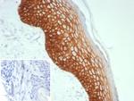 Desmoglein-3 (Squamous Cell Marker) Recombinant Rabbit Monoclonal Antibody (DSG3/8613R)
