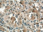Thrombospondin 1 Antibody in Immunohistochemistry (Paraffin) (IHC (P))