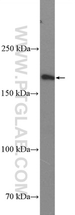 Thrombospondin 1 Antibody in Western Blot (WB)