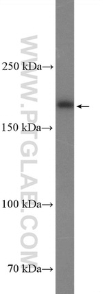 Thrombospondin 1 Antibody in Western Blot (WB)