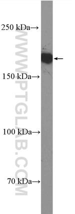 Thrombospondin 1 Antibody in Western Blot (WB)