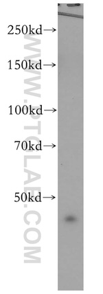 CSF2RA/CD116 Antibody in Western Blot (WB)
