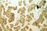 CSF2RA/CD116 Antibody in Immunohistochemistry (Paraffin) (IHC (P))