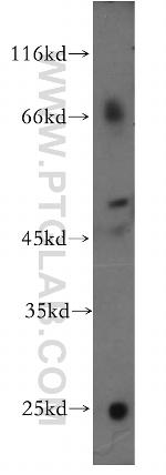 CSF2RA/CD116 Antibody in Western Blot (WB)