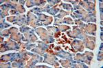 ERO1LB Antibody in Immunohistochemistry (Paraffin) (IHC (P))