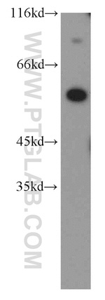 ERO1LB Antibody in Western Blot (WB)