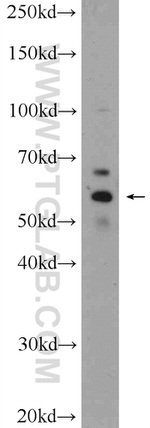 ERO1LB Antibody in Western Blot (WB)