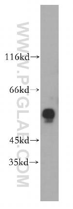 ERO1LB Antibody in Western Blot (WB)